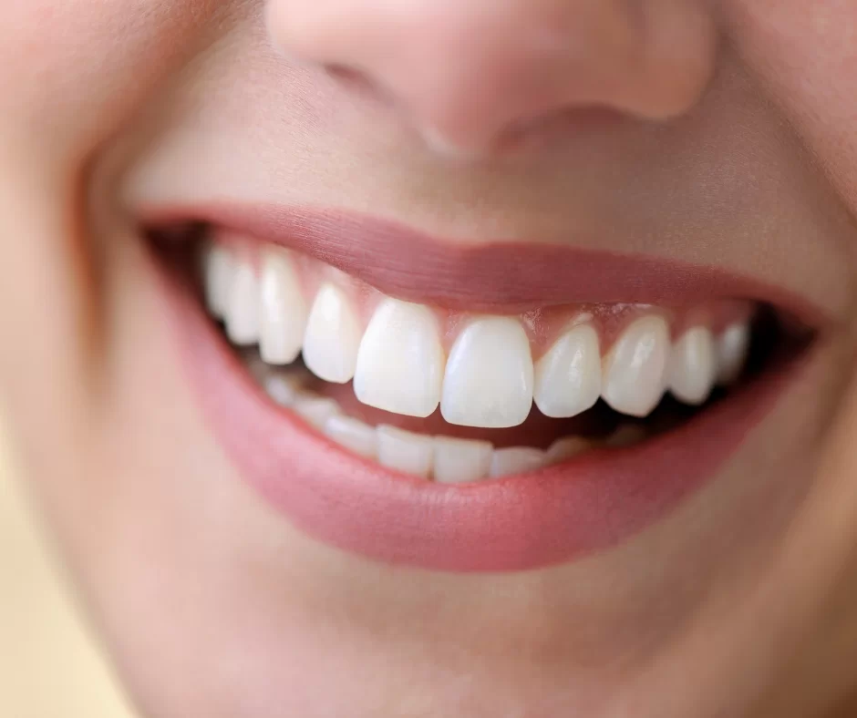 O Papel dos Interdentais na Manutenção de um Sorriso Saudável